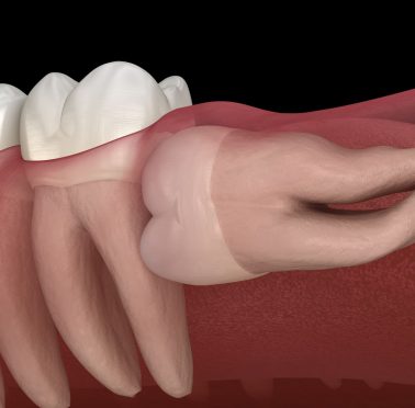 Treatment - Chaulden Practice