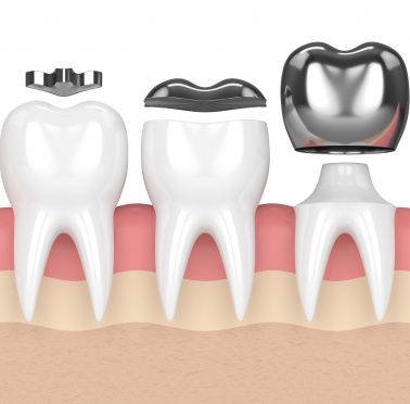 Treatment - Chaulden Practice